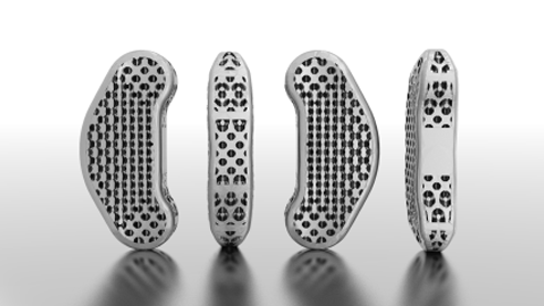 Spinal implant encouraging bone fusion produced with EOS Additive Manufacturing technology. (Source: Autodesk Within Medical)